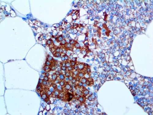 IHC of Parathyroid Hormone on an FFPE Parathyroid Tissue